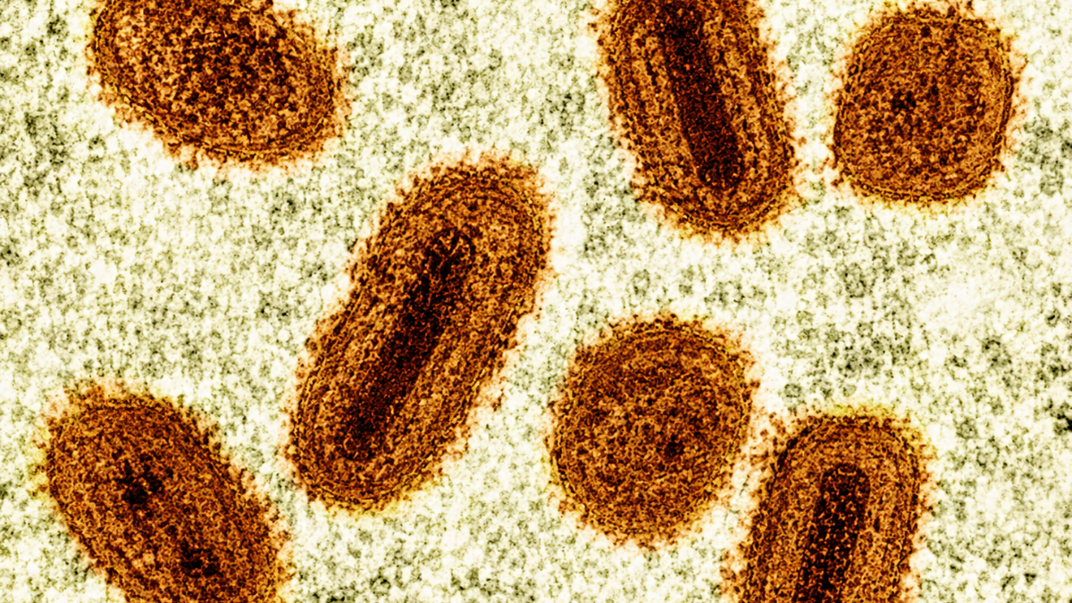 2 scientists charged with bringing deactivated mpox virus into the US and lying to authorities