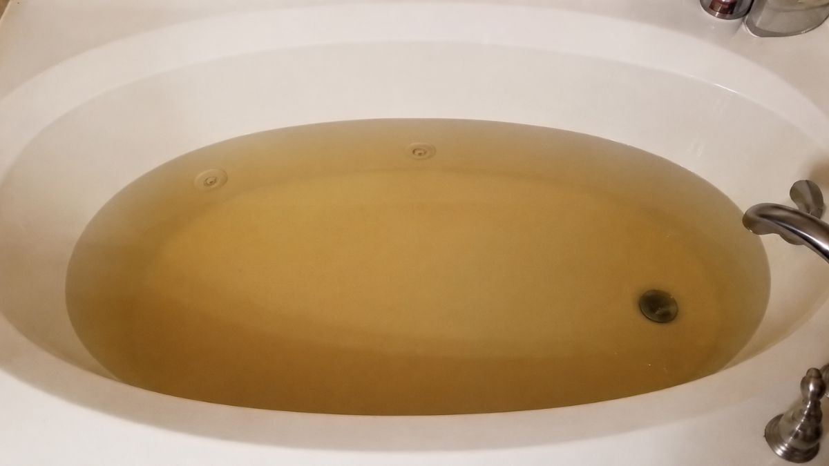 Trinidad family says daughter suffered chemical burn after showering with city's water